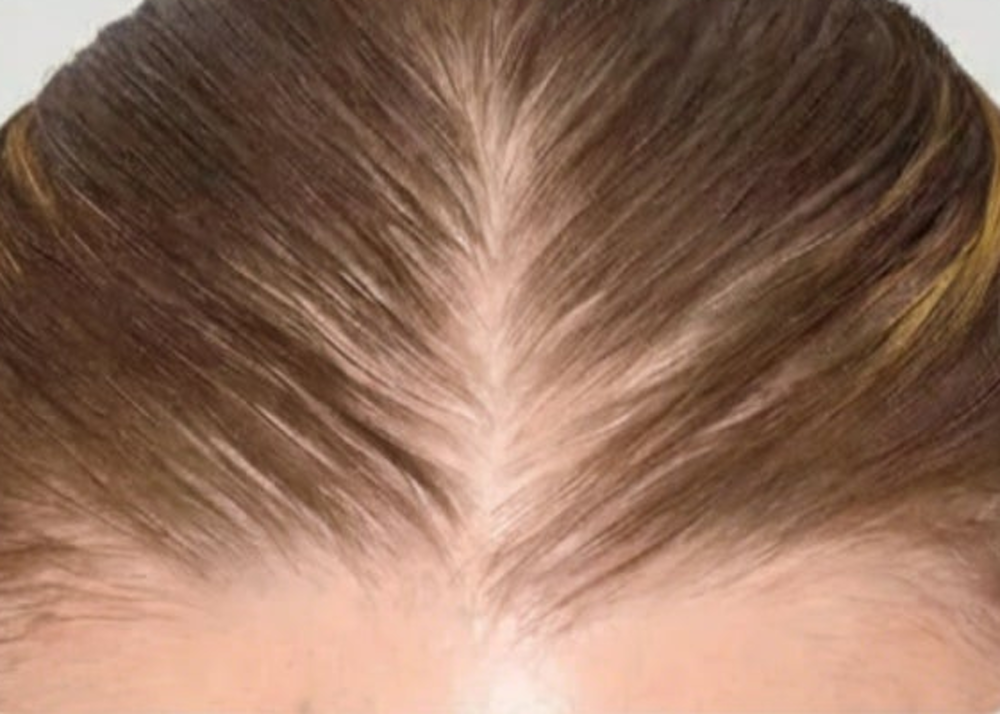 Glow & Go hair concealer on roots — before