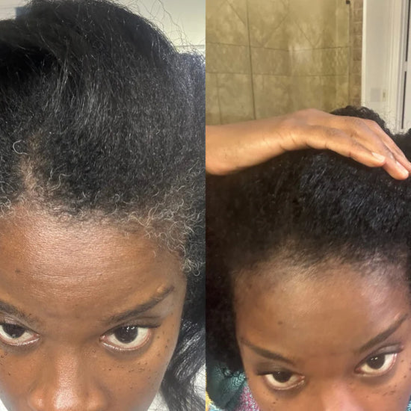 Before and after result shared by Demara O.