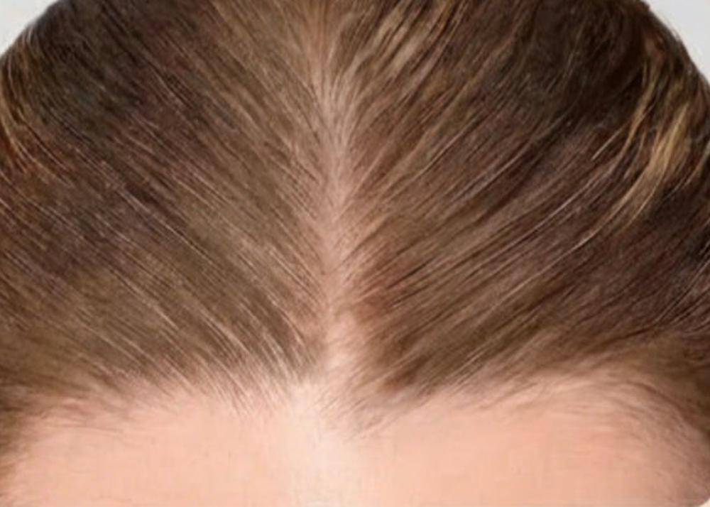 Glow & Go hair concealer on roots — after